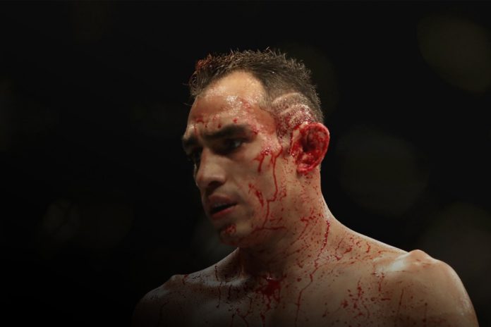 UFC Tony Ferguson